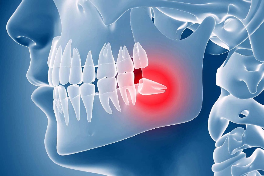 Denti del giudizio problemi