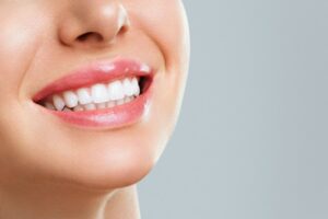 Sorriso perfetto