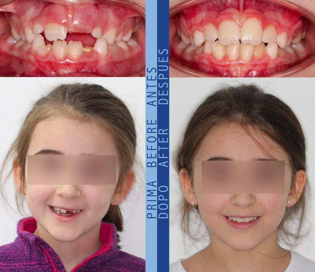giulia prima e dopo