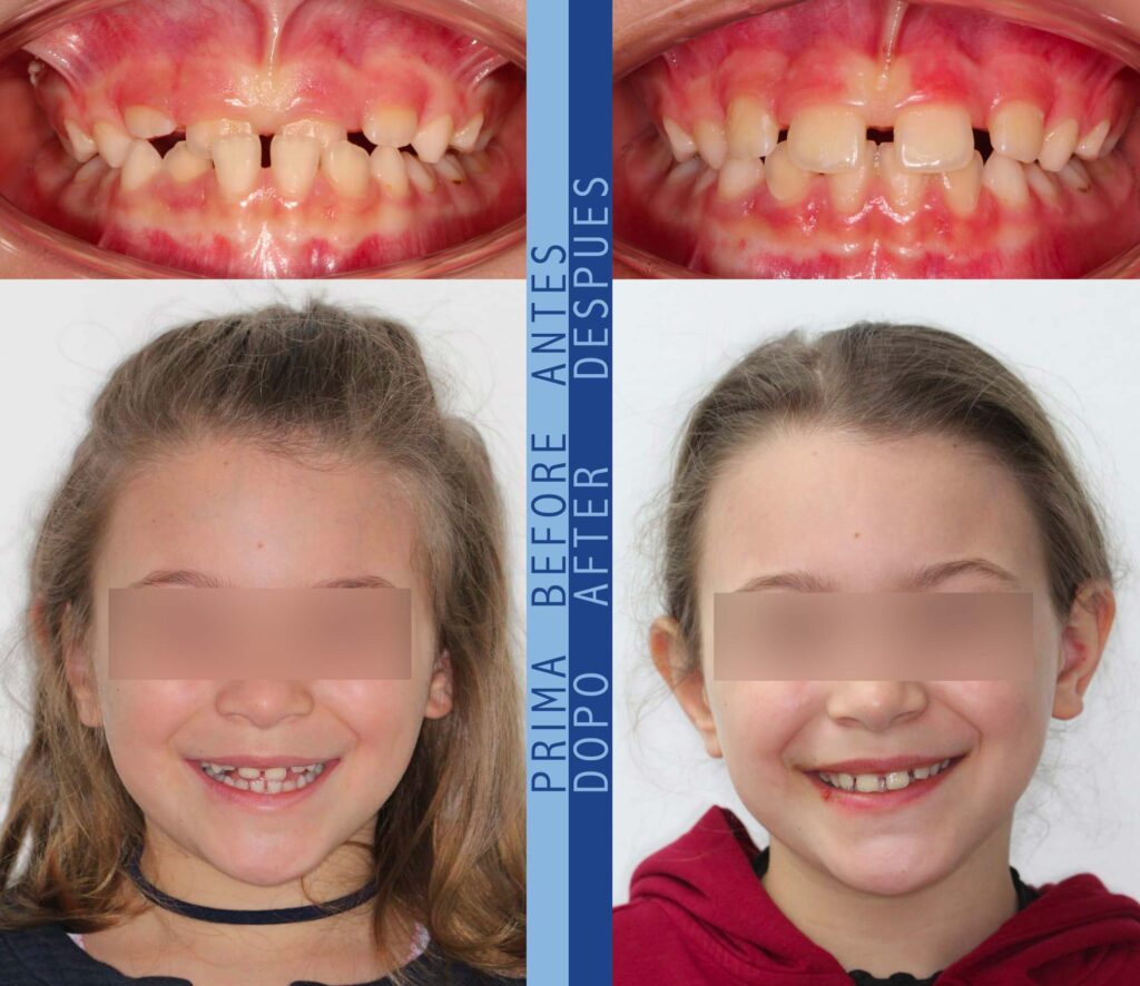 Marta prima e dopo