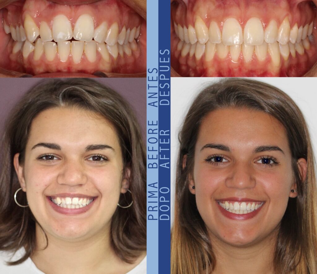 Sara prima e dopo