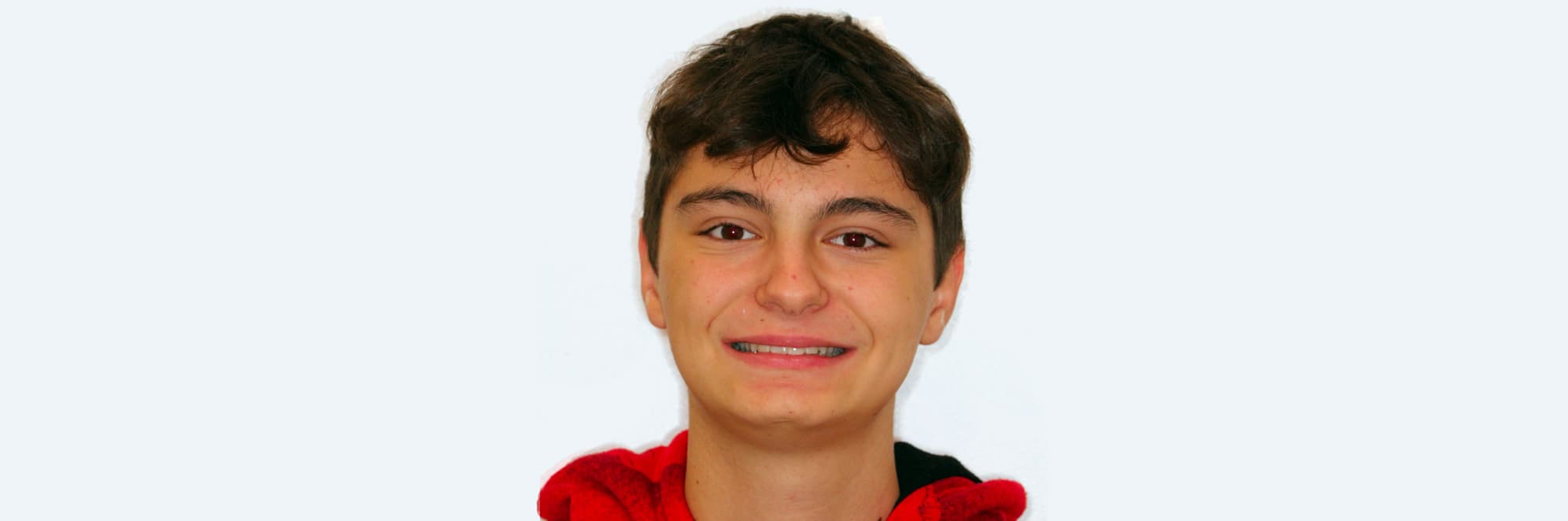 Andrea sorride con sorriso nuovo